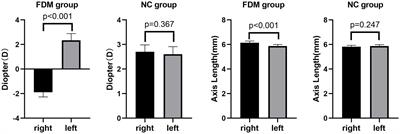 Altered whole-brain gray matter volume in form-deprivation myopia rats based on voxel-based morphometry: A pilot study